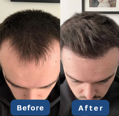 Follix Hair Growth