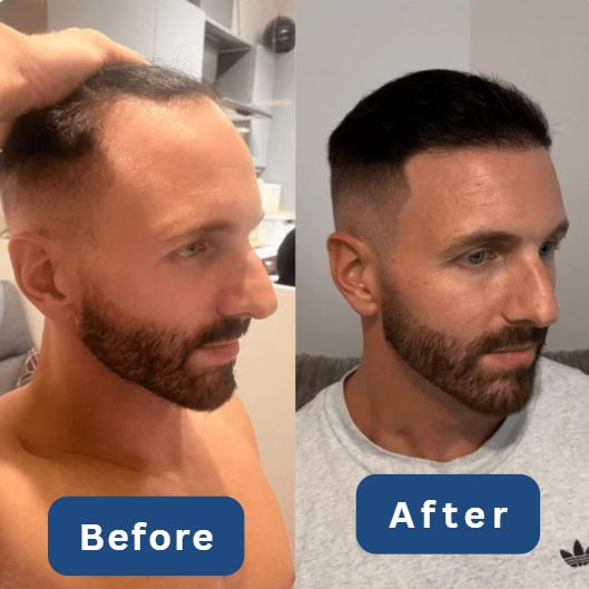 Follix Hair Growth